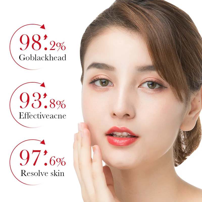 BIOAQUA Салициловая кислота, э – обзор и цена Azelaic Acid Serum