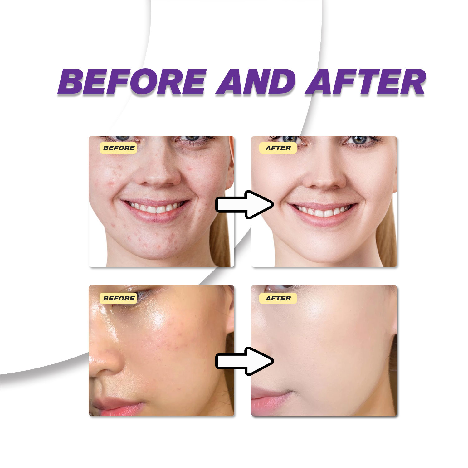Мягкий крем с азелаиновой кисл – обзор и цена Azelaic Acid Serum
