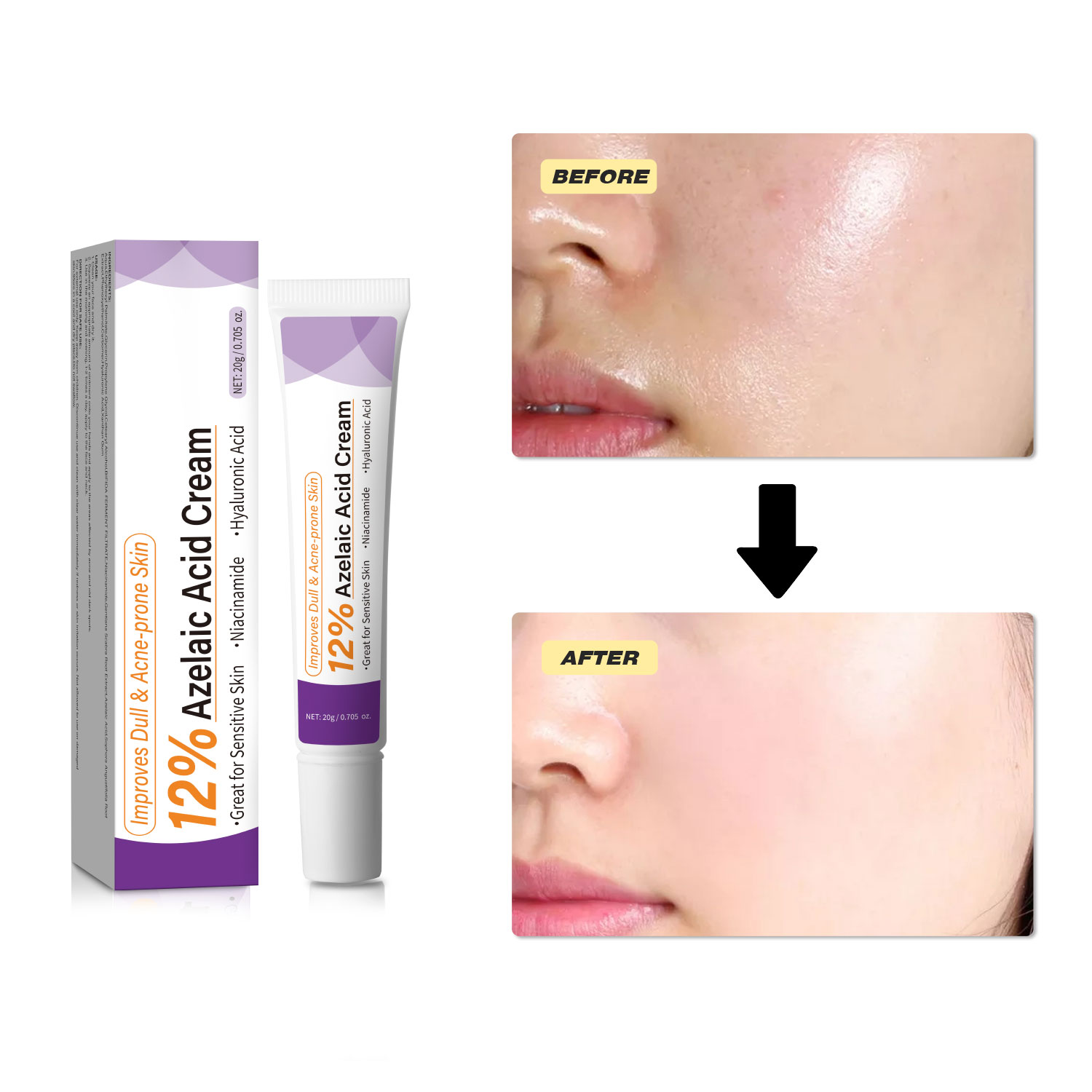 Мягкий крем с азелаиновой кисл – обзор и цена Azelaic Acid Serum