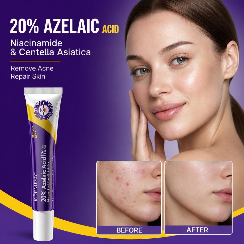 Эссенция с 20% азелаиновой кис – обзор и цена Azelaic Acid Serum