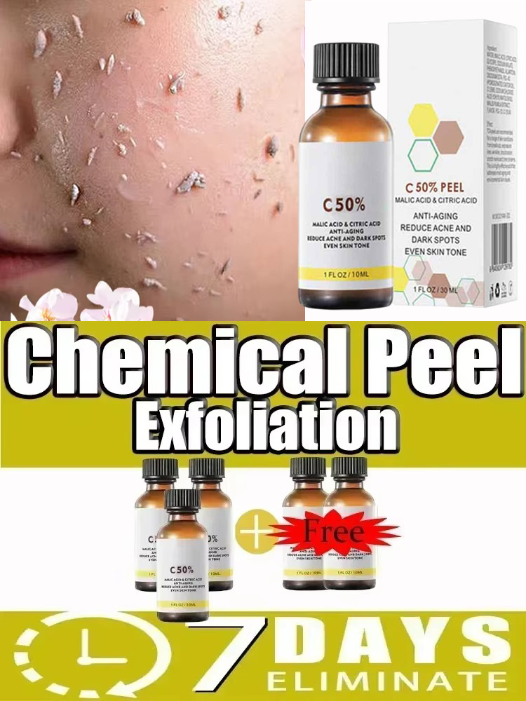 3-й этап пилинг-процедуры: мас – обзор и цена Azelaic Acid Serum